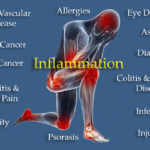 Causes of Inflammation